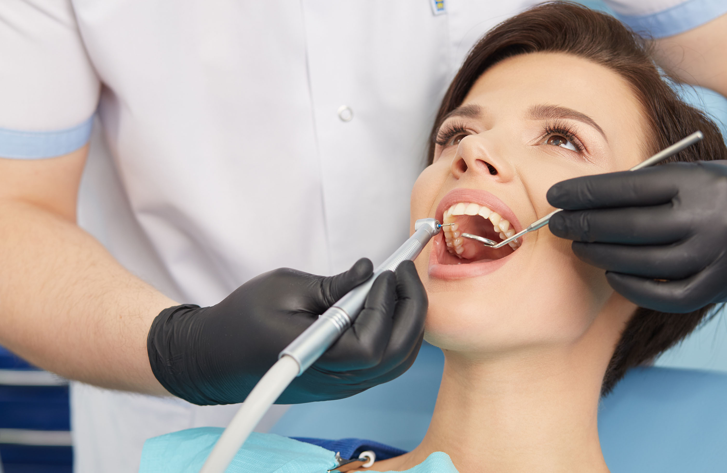 dental fillings